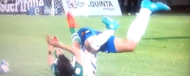 biskuvic-fracture-universida